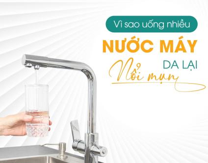 Vì sao sử dụng nước máy lại gây mụn?