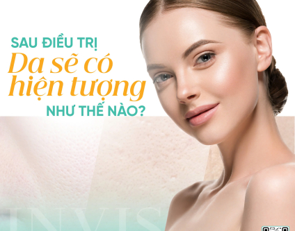 Sau điều trị sẹo rỗ, da sẽ thay đổi như thế nào? Điều cần biết để không hoang mang!