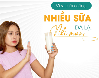 Sữa đậu nành có thực sự gây mụn? Sự thật khiến bạn bất ngờ!