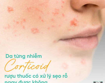 Da từng nhiễm corticoid, rượu thuốc có xử lý sẹo rỗ ngay được không?