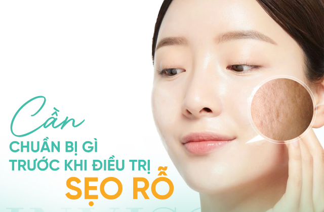 Cần chuẩn bị gì trước khi điều trị sẹo rỗ?