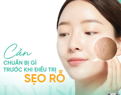 Cần chuẩn bị gì trước khi điều trị sẹo rỗ?