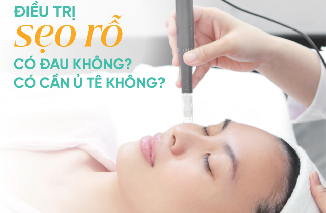 Điều trị sẹo rỗ có đau không? Có cần ủ tê không?