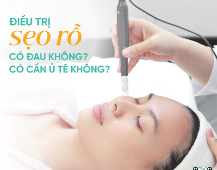Điều trị sẹo rỗ có đau không? Có cần ủ tê không?