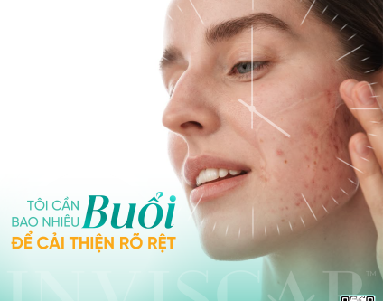 Cần bao nhiêu buổi để cải thiện sẹo rõ rệt?