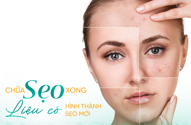 Sau khi điều trị xong, sẹo có bị tái lại không?