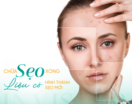 Sau khi điều trị xong, sẹo có bị tái lại không?