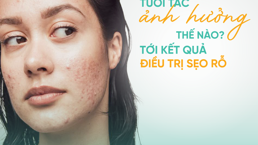 Tuổi tác ảnh hưởng như thế nào tới kết quả điều trị sẹo rỗ?