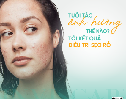 Tuổi tác ảnh hưởng như thế nào tới kết quả điều trị sẹo rỗ?