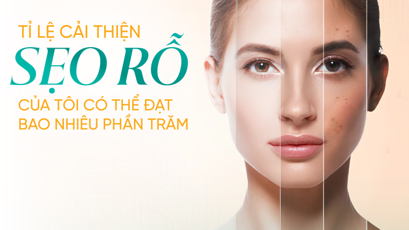 Tỷ lệ cải thiện sẹo rỗ: Bạn có thể đạt bao nhiêu phần trăm?