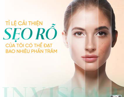 Tỷ lệ cải thiện sẹo rỗ: Bạn có thể đạt bao nhiêu phần trăm?